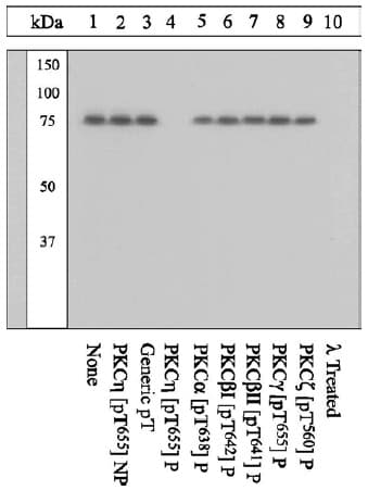 Anti-PKC eta (phospho T655) antibody(ab5798)