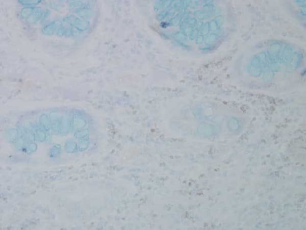 Anti-3-Nitrotyrosine antibody [39B6](AB61392)