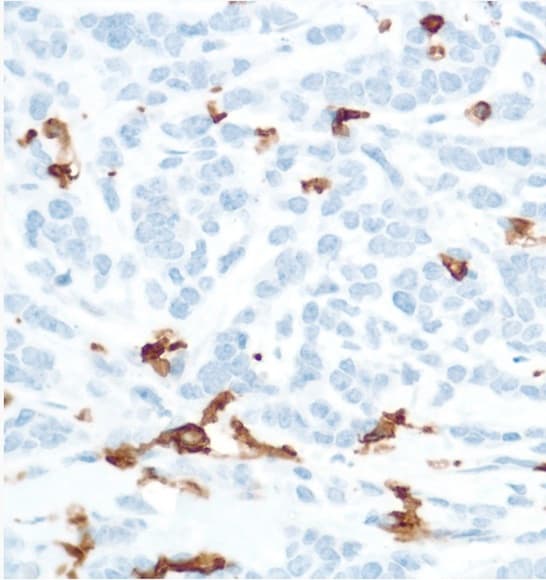 Cd16 Antibody Sp175 Ab183354  Immunohistochemistry Formalin Pfa Fixed Paraffin Embedded Sections Img43497