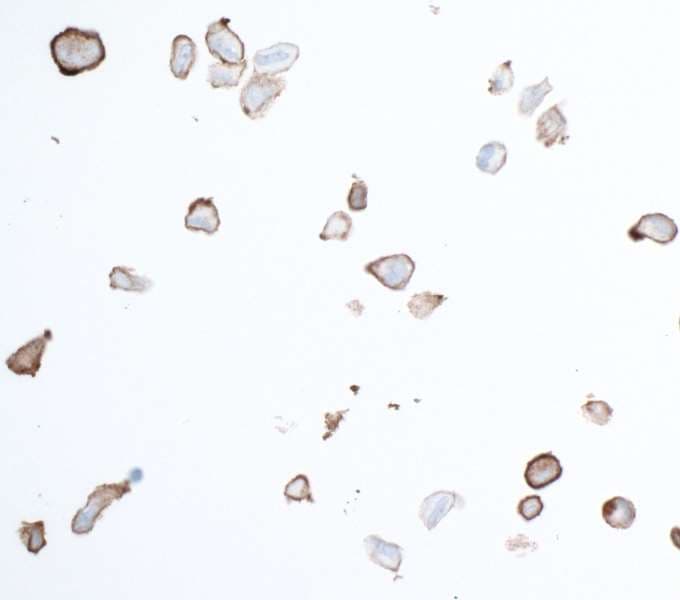 Anti-PDGFR beta antibody [BLR081G] - BSA free(AB314096)