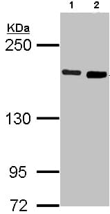 Diaph1 Antibody Ab96784  Western Blot Img86007