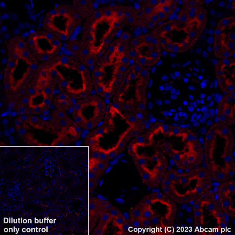 Alexa Fluor® 555 Anti-Folate Binding Protein/FBP antibody [EPR20277](ab309247)