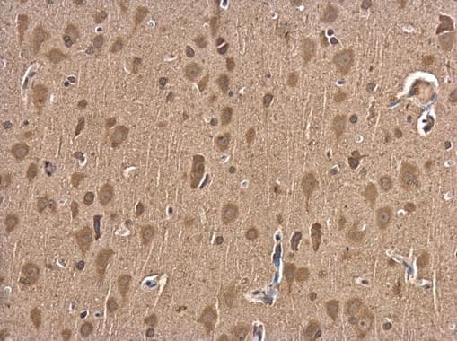 Anti-p75 NGF Receptor antibody(AB227509)