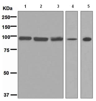 Grp94 Antibody Epr3988 Ab108606  Western Blot Img119631