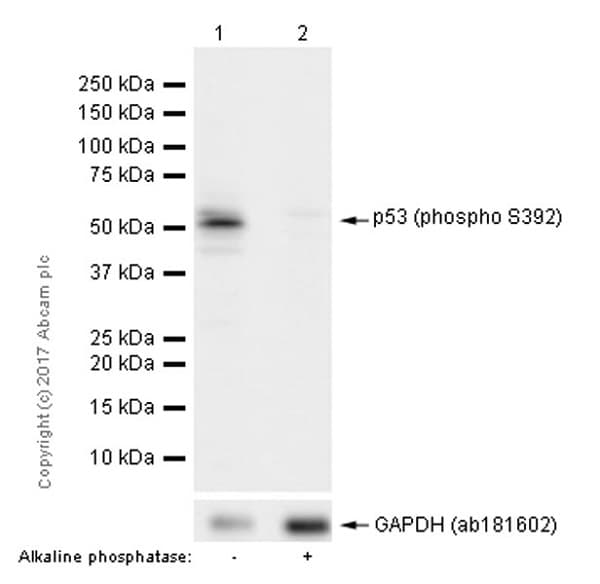 Anti-p53 (phospho S392) antibody [EP155Y] - BSA and Azide free(ab239211)