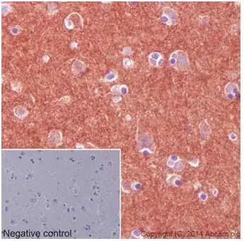 Anti-Pan Trk antibody [EPR17341](AB181560)