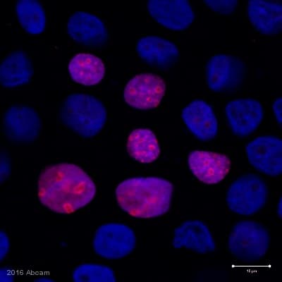 Anti-Ki67 antibody [EPR3610](AB92742)