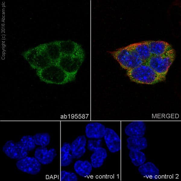 Anti-CNOT7 antibody [EPR18722](AB195587)
