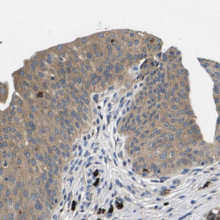 Plce1 Antibody Ab121476  Immunohistochemistry Formalin Pfa Fixed Paraffin Embedded Sections Img122840