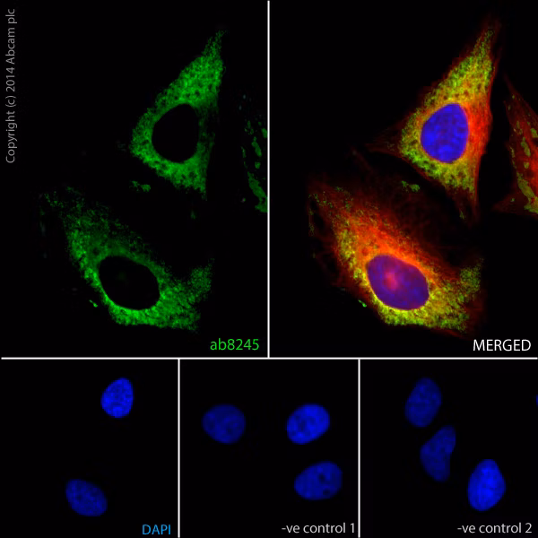 HeLa cells stained with ab8245 (GAPDH) and DAPI (nuclear DNA), showing specific staining and negative controls for unspecific antibody reactions.