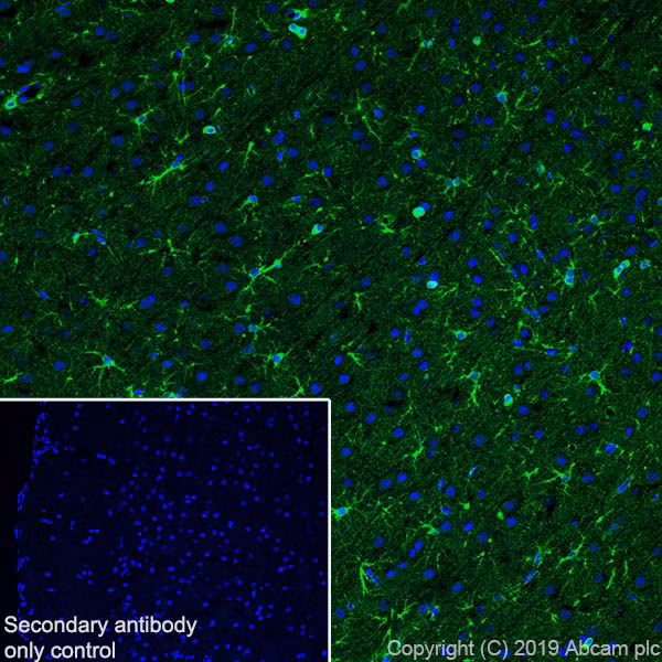 Immunohistochemistry analysis of rat cerebral cortex tissue sections showing BDNF expression.