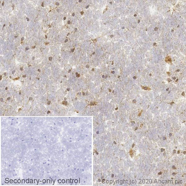 IHC image showing BDNF staining in normal human cerebral cortex. DAB chromogen, counterstained with hematoxylin. Inset shows a negative control without primary antibody.