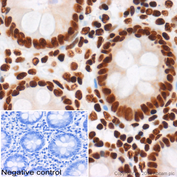 IHC image of Histone H3 (acetyl K27) staining in human colon tissue.