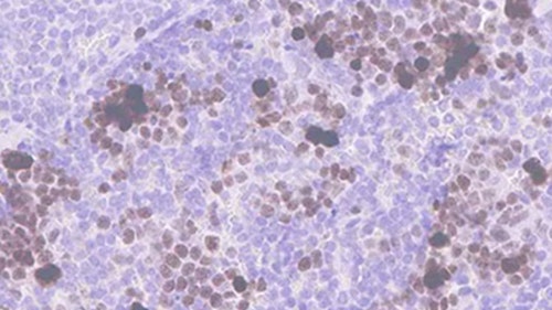 Anti-Ki67 antibody [SP6]
